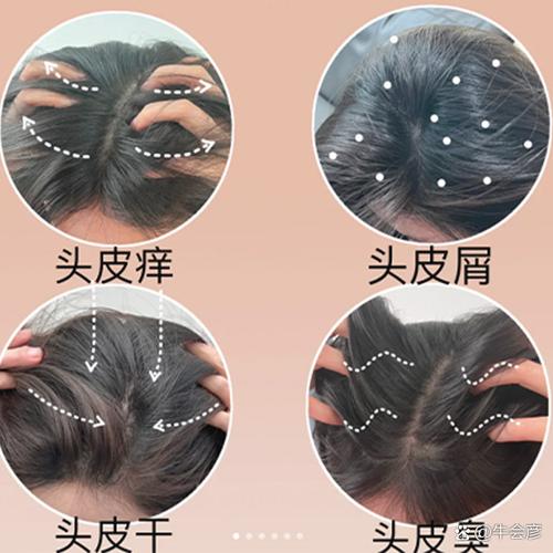 头发变红是什么原因