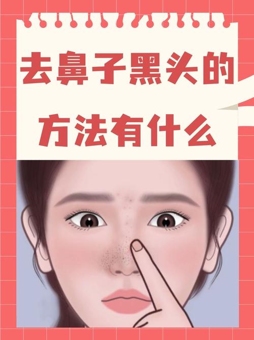 为什么鼻子会有黑头