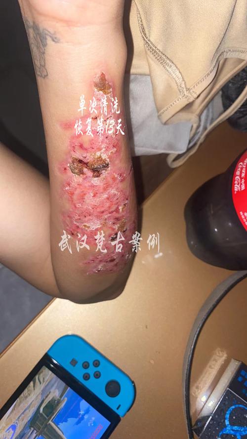 纹身贴用什么洗