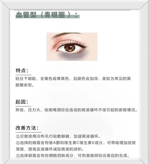 黑眼圈吃什么维生素