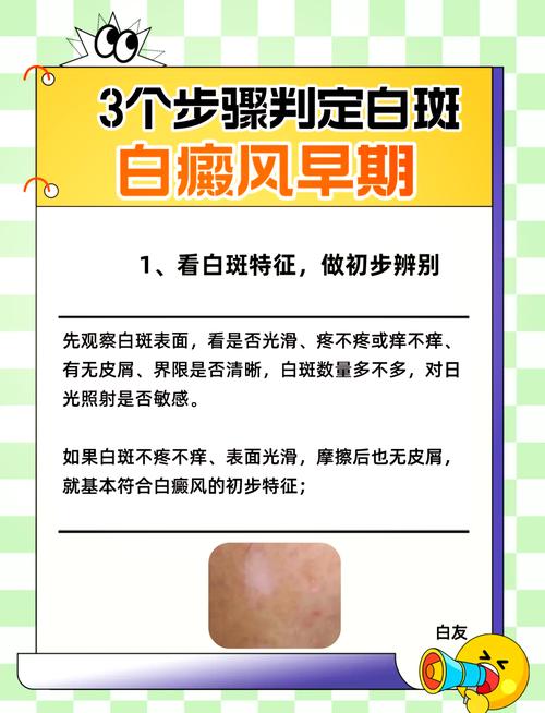 白斑和白斑有什么区别
