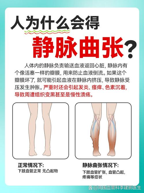小腿酸软是什么原因