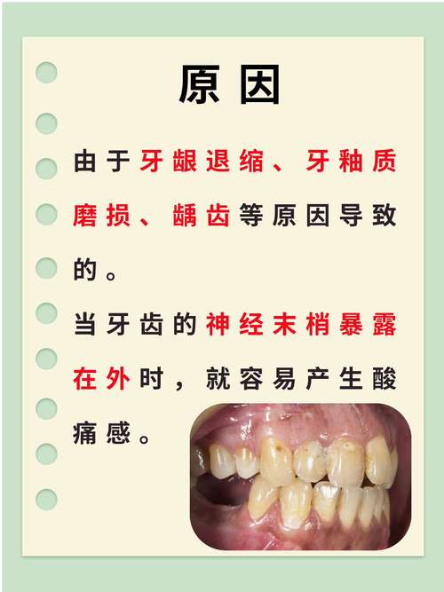 牙齿痛是什么引起的