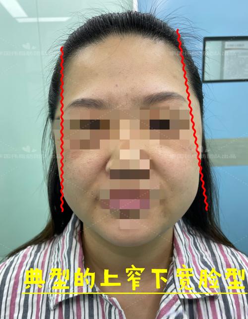 上窄下宽是什么脸型