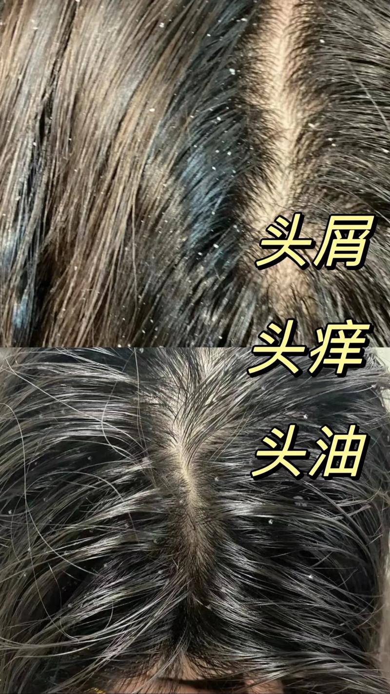 头发为什么油的快