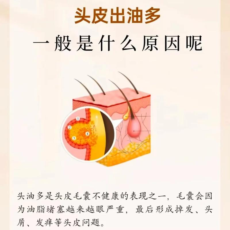 头发为什么油的快