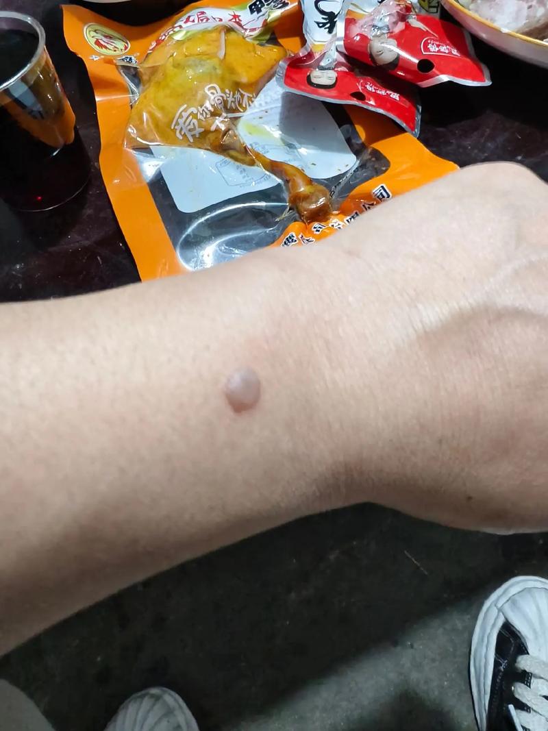 烟疤是什么意思