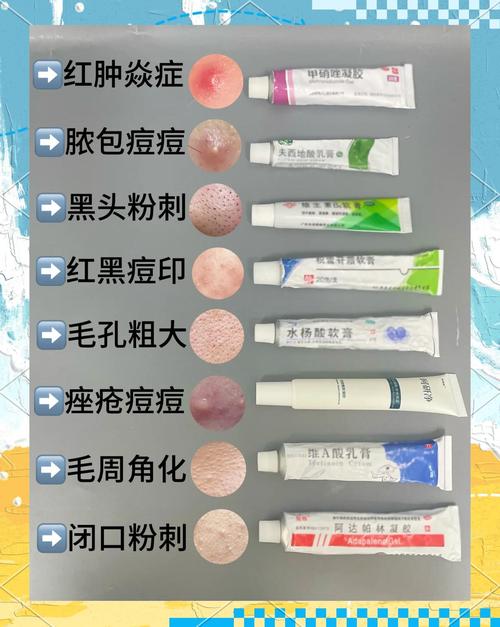 祛痘用什么产品