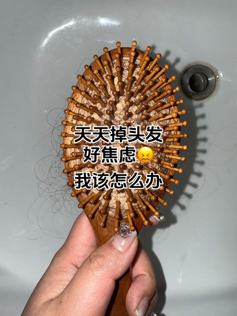 减肥为什么会掉发