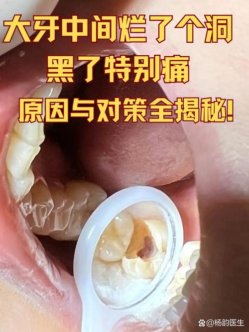 牙齿发黑是什么病