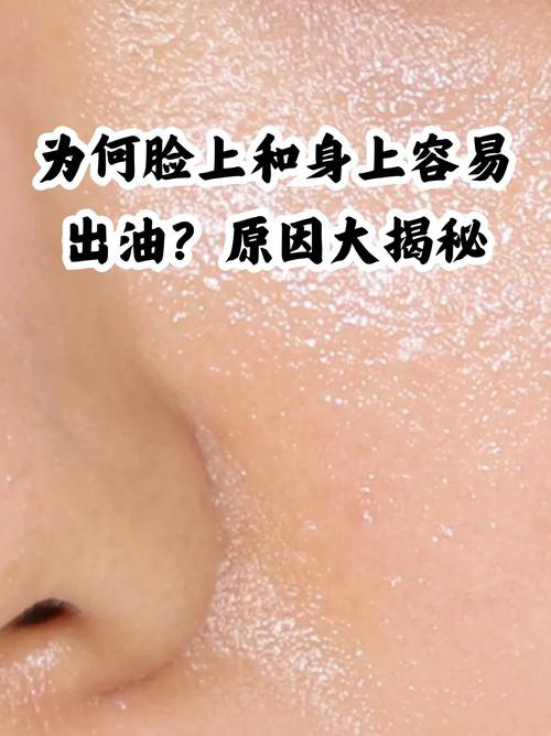 脸部为什么会出油