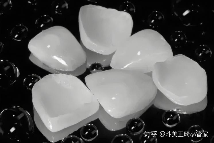 什么是牙贴面