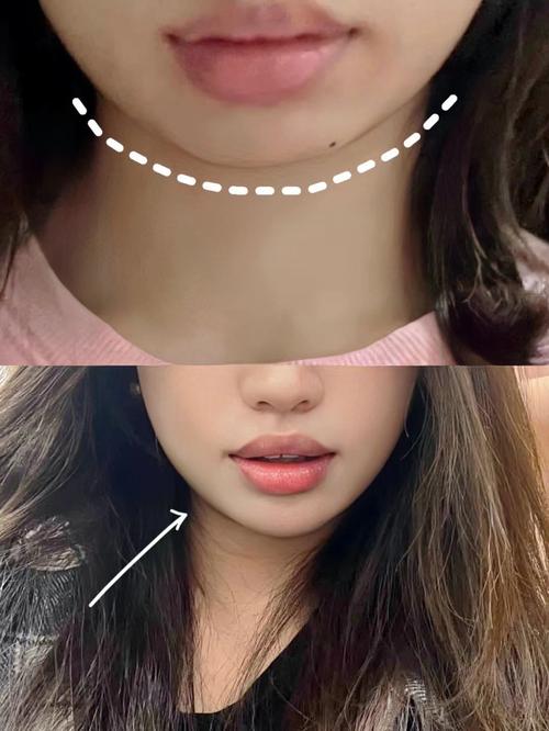 下巴短是什么原因