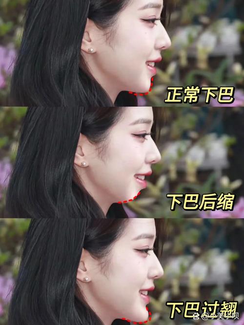 下巴短是什么原因