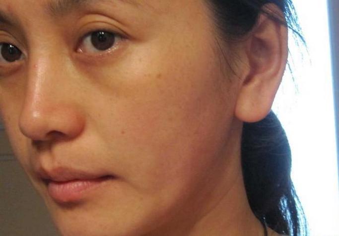 皮肤蜡黄是什么原因