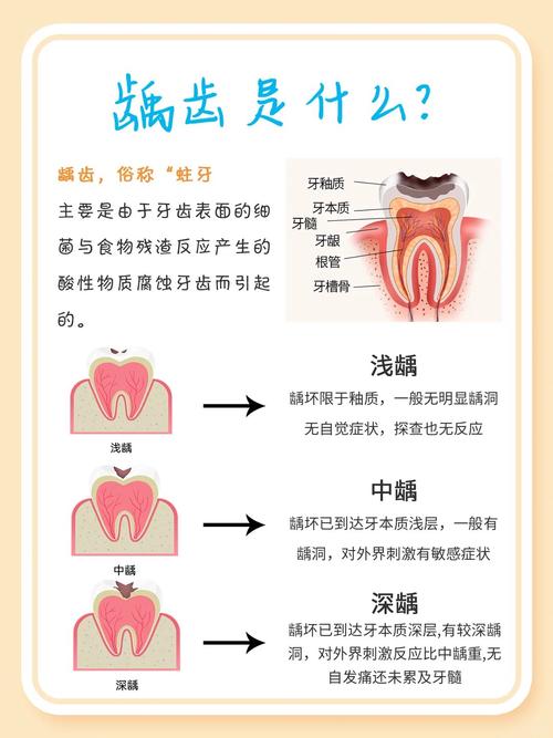 牙齿蛀牙是什么原因