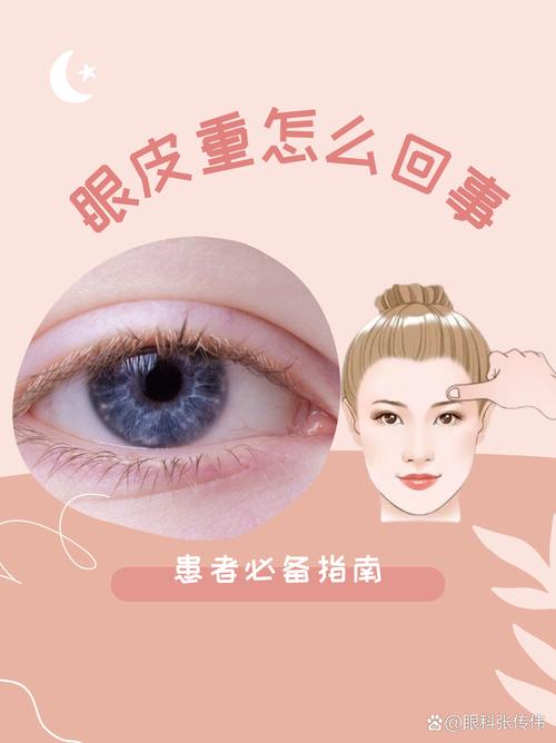 重眼是什么原因