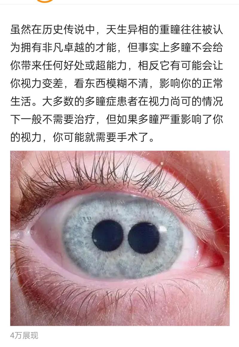 重眼是什么原因