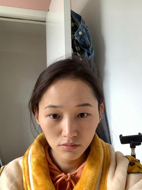 颧骨高是什么样子