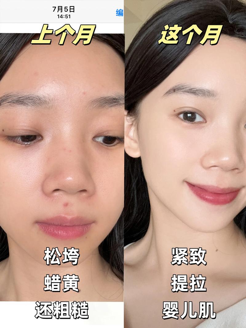 为什么脸肉多