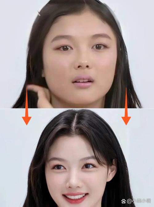 为什么脸肉多