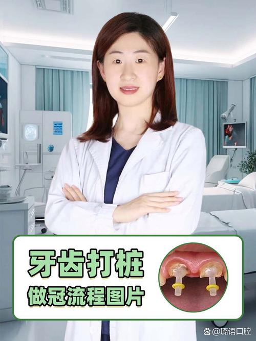 做牙冠什么意思