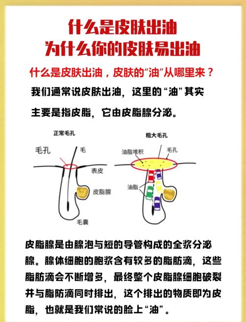 为什么皮肤容易出油