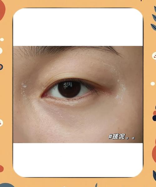 眼霜为什么会搓泥