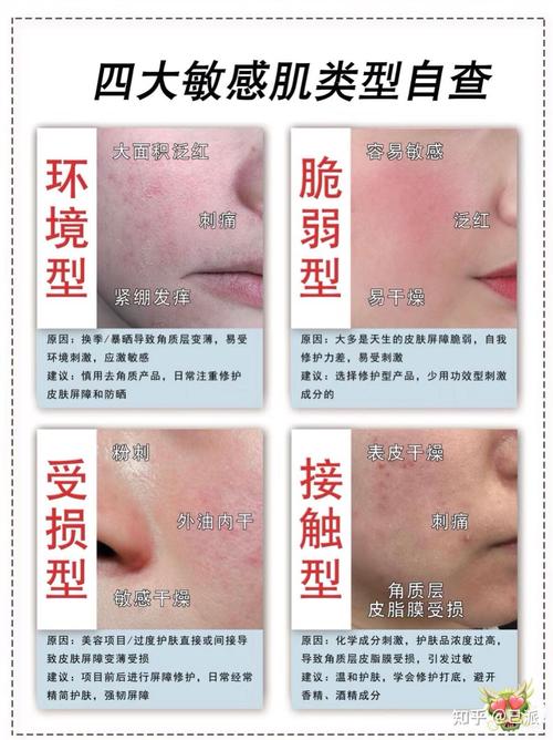 皮肤敏感是什么原因