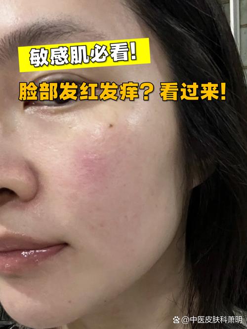 皮肤敏感是什么原因