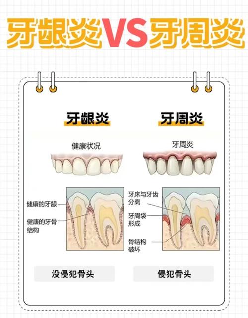牙龈炎有什么症状