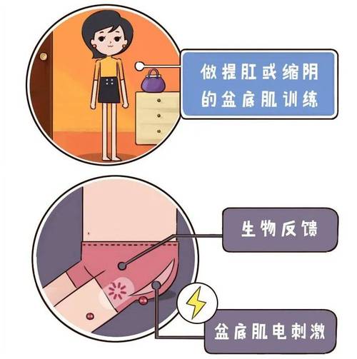 阴道松弛什么原因