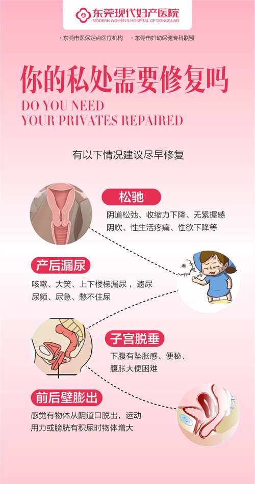 阴道松弛什么原因