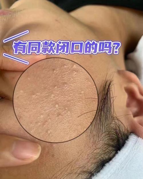 闭口里面是什么