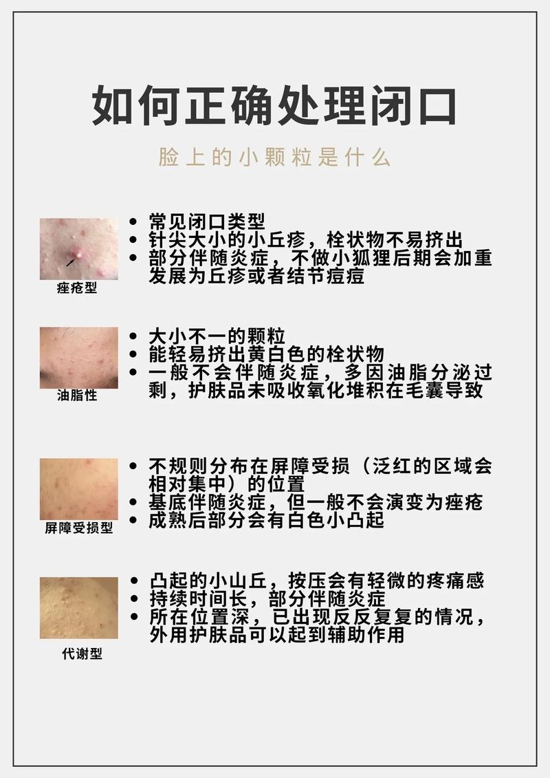 闭口里面是什么