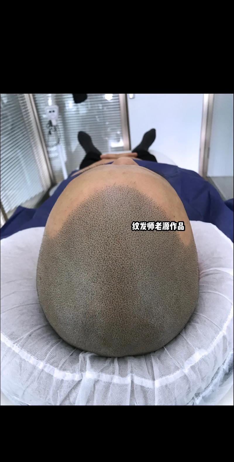 什么是纹发