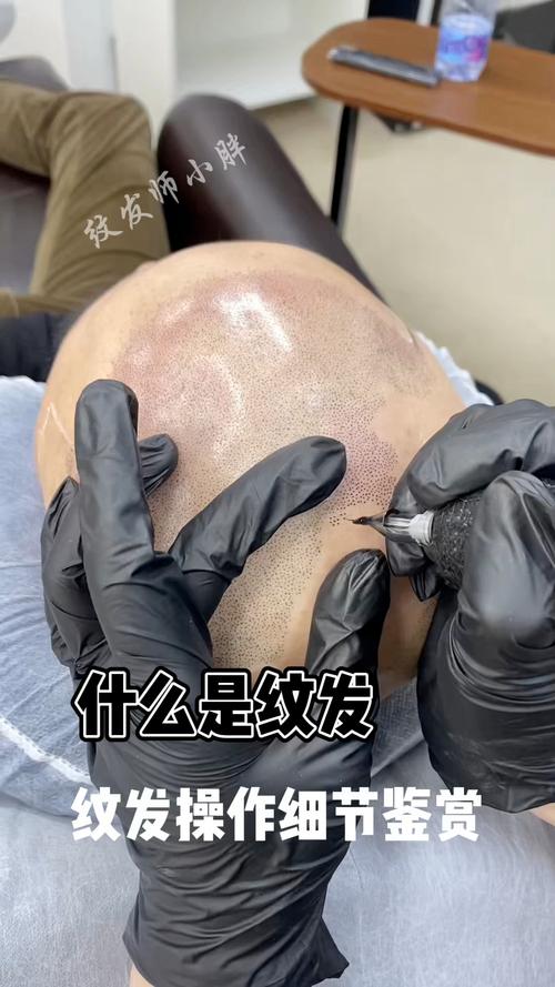 什么是纹发