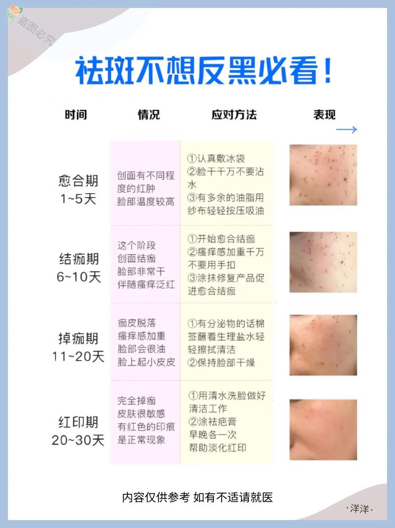 激光祛斑什么不能吃