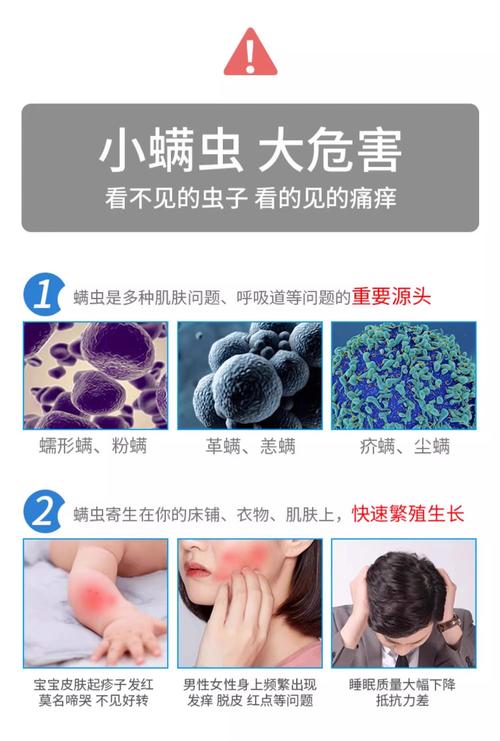 什么东西可以除螨