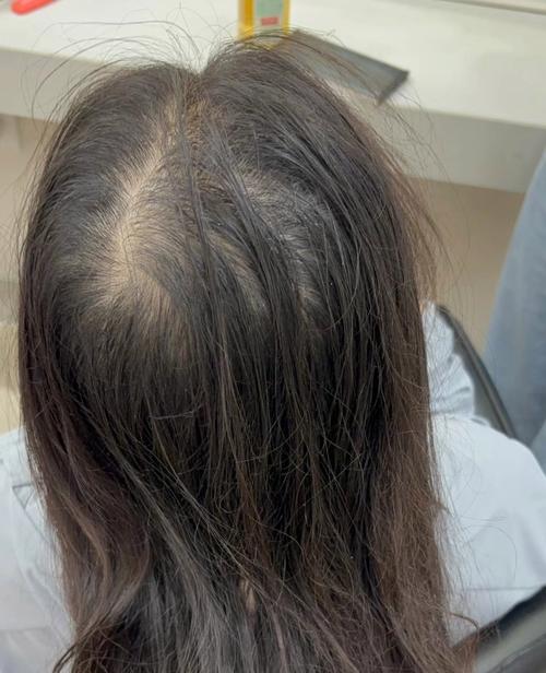 发梢是什么意思