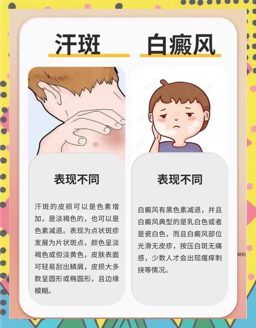 汗斑是什么引起的