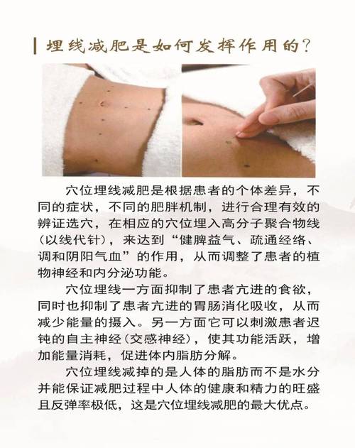 什么叫中医埋线减肥