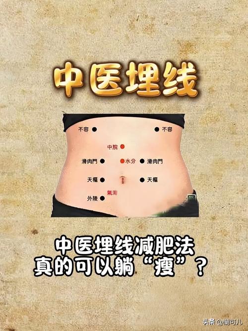 什么叫中医埋线减肥