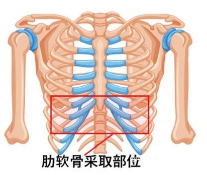 什么是肋软骨