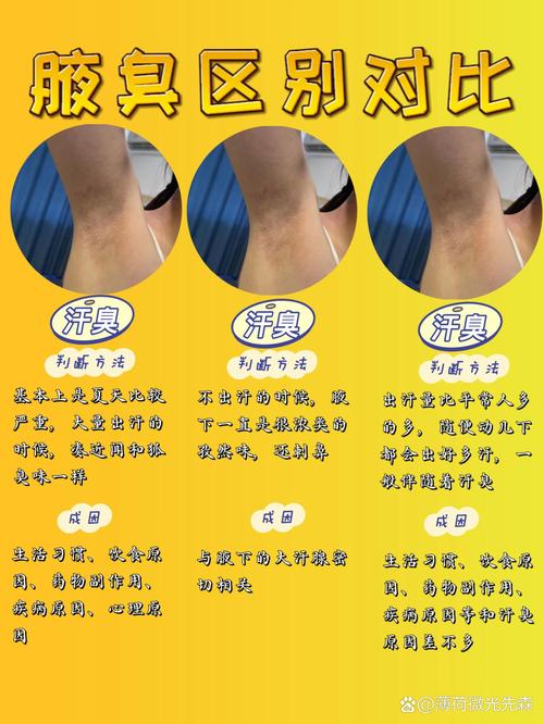 腋臭有什么危害