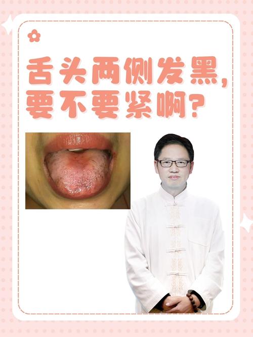 舌头发黑什么情况