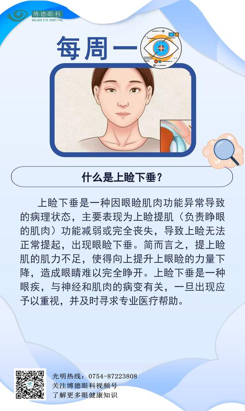 眼皮下垂是什么病