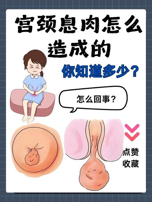 宫颈息肉做什么检查