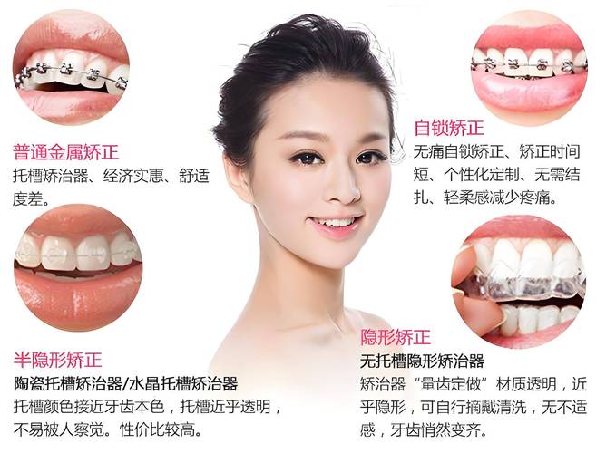 矫正牙齿有什么方法