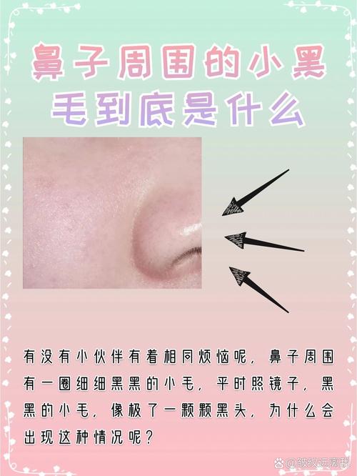 为什么鼻子上长毛